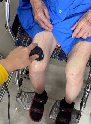 ĐIỀU TRỊ CỨNG KHỚP GỐI SAU PHẪU THUẬT